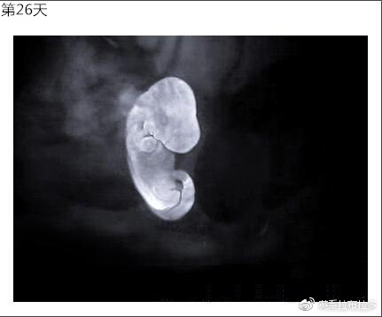 第26天