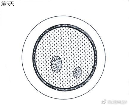 第5天